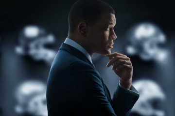 CONCUSSION